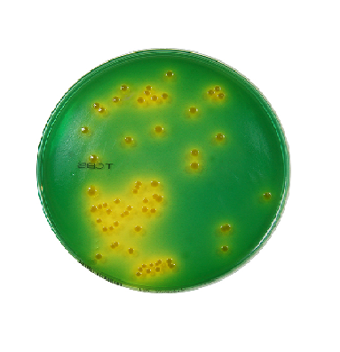 TCBS (Thiosulfate Citrate Bile Sucrose) Agar